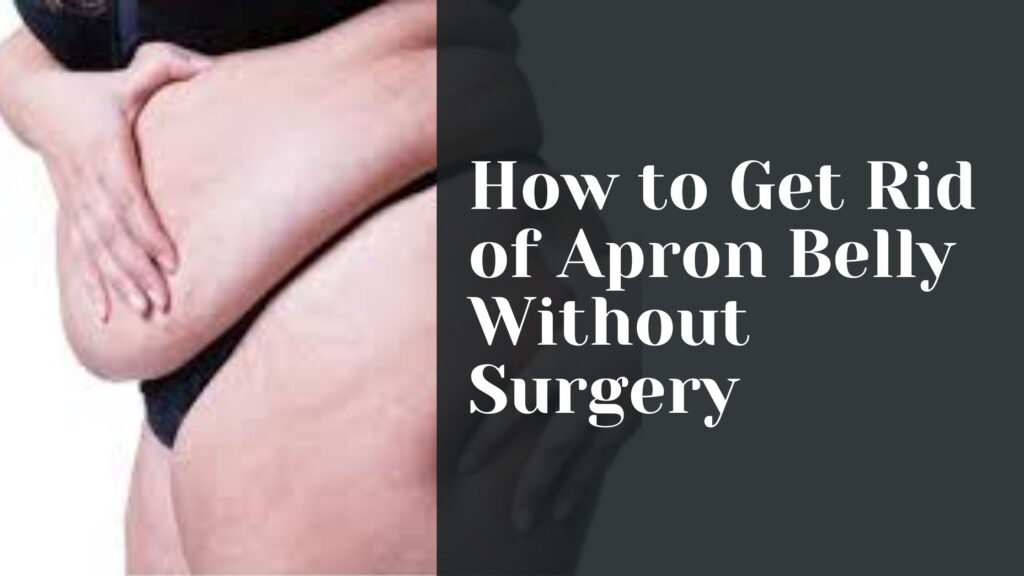 How to Get Rid of Apron Belly Without Surgery