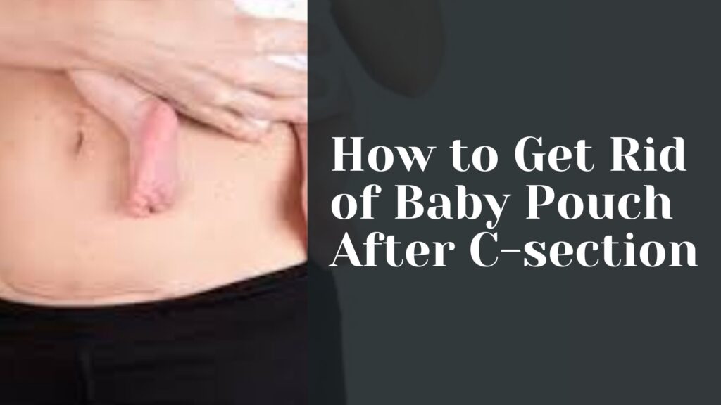 How to Get Rid of Baby Pouch After C-section