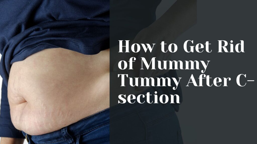 How to Get Rid of Mummy Tummy After C-section