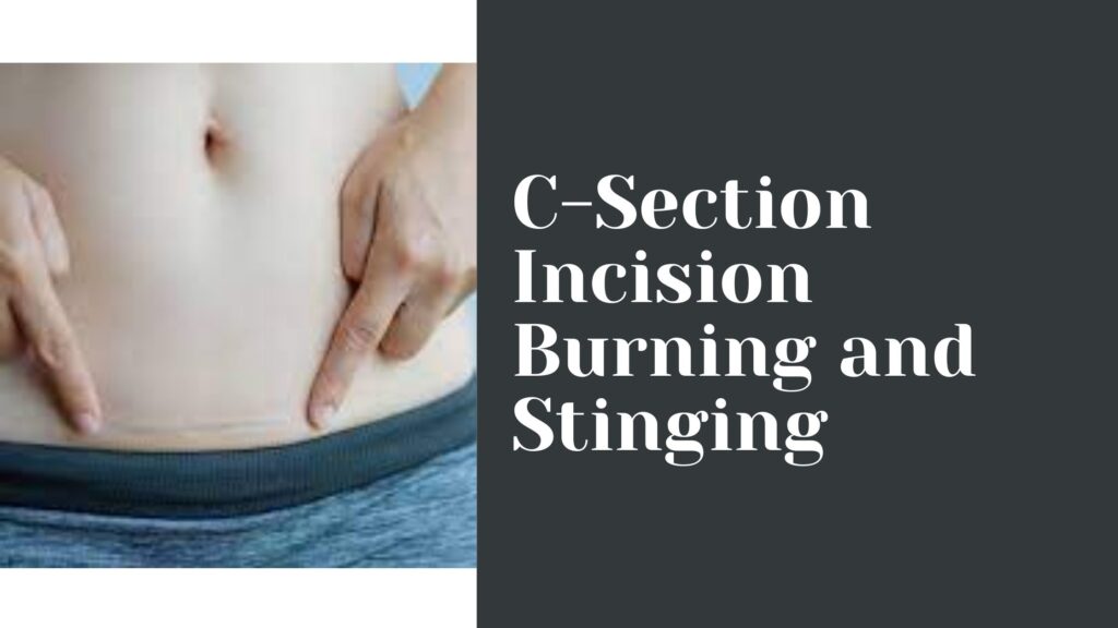 C-Section Incision Burning and Stinging