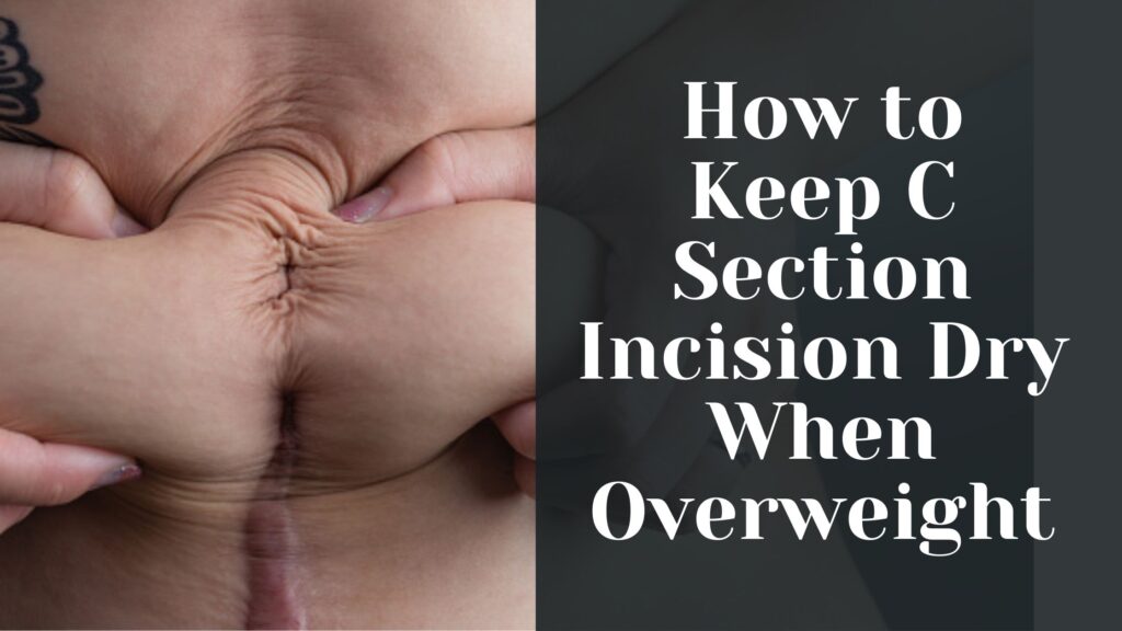 How to Keep C Section Incision Dry When Overweight
