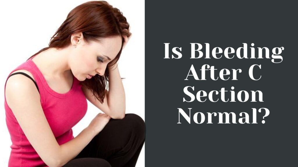 Is Bleeding After C Section Normal